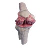 Modèle implant genou