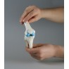 Modèle implant genou