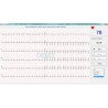 ECG numérique PC SE-1010 Edan, 12 dérivations