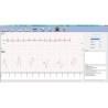ECG numérique PC SE-1010 Edan, 12 dérivations