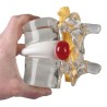 Simulateur de hernie discale