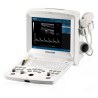 Echographe portable DUS60 edan sans sonde