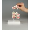 Modèle de vertèbres à ostéoporose, 3 vertèbres 