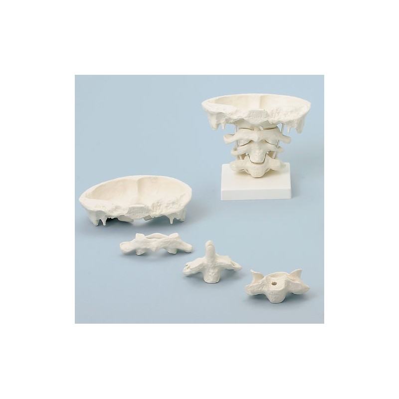 Articulation de la tête, grossissement x 2, avec ou sans support