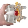 Simulateur de hernie discale
