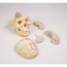 Crâne neurovasculaire avec cerveau 