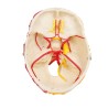 Crâne neurovasculaire avec cerveau 