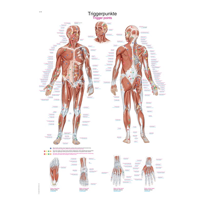 Planche anatomique des points Trigger