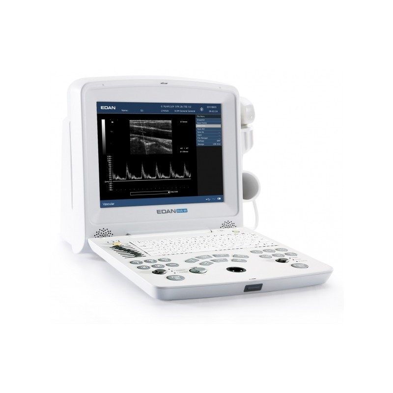Echographe portable DUS60 Edan-Sonde linéaire L761-2 