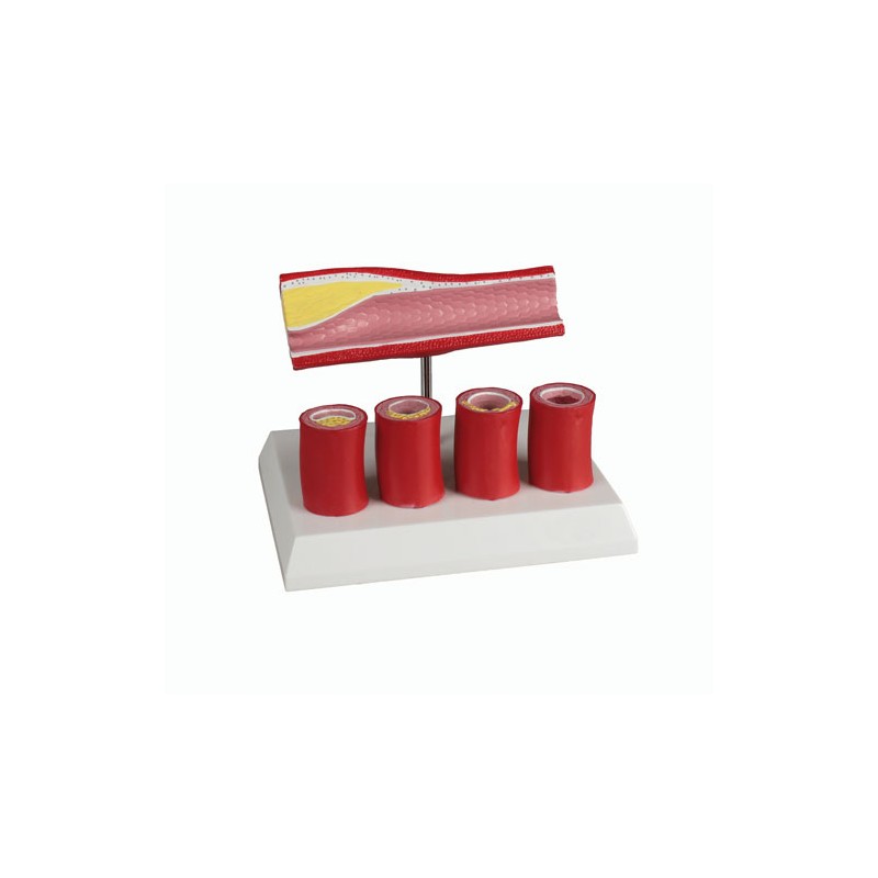 Modèle d'artère avec 4 sections artérielles