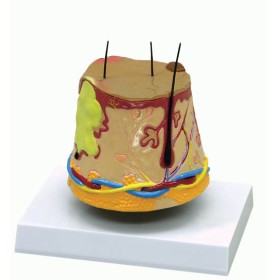 Modèle anatomique de l'acné -